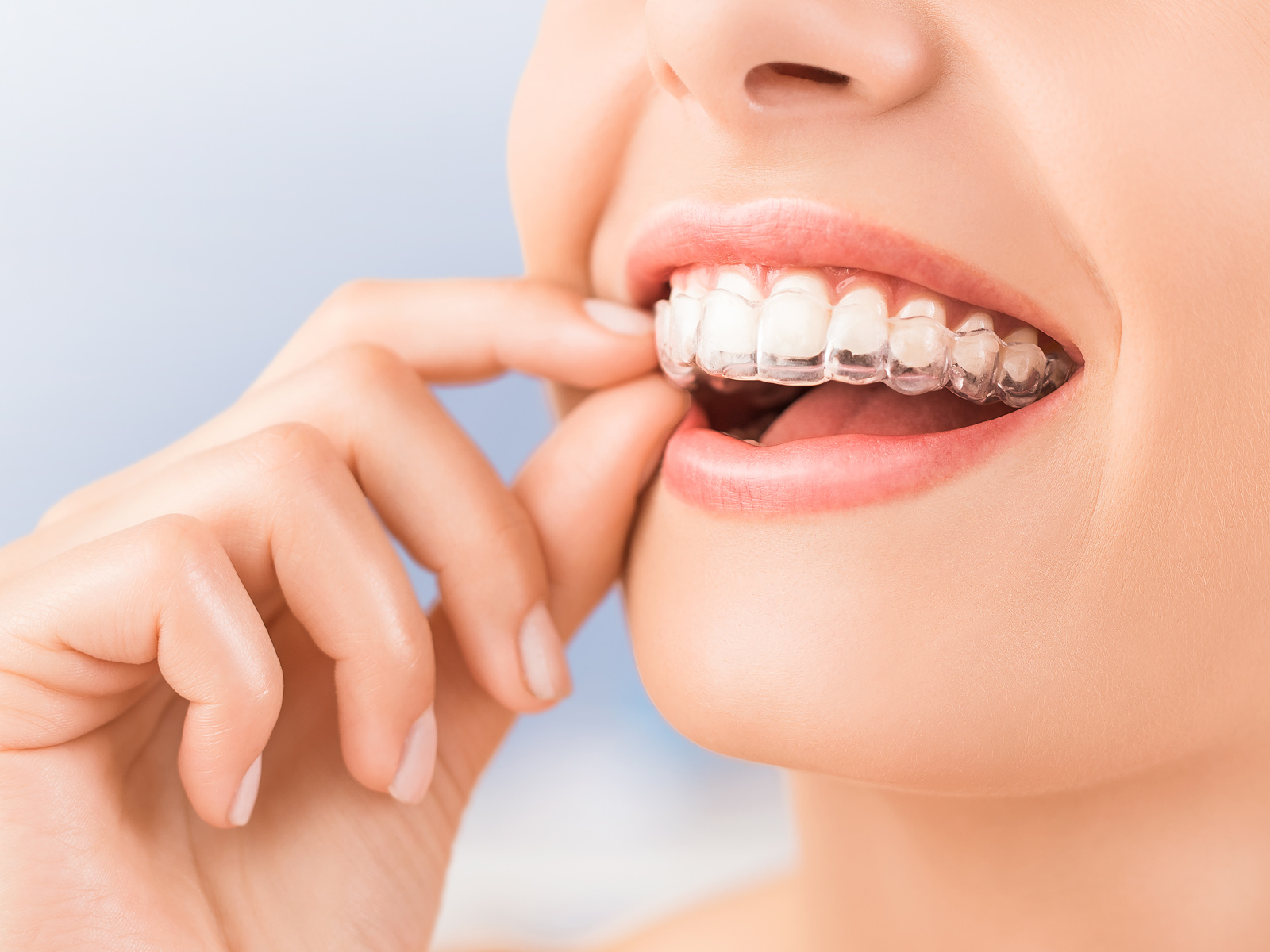 How can you tell if Invisalign is working?