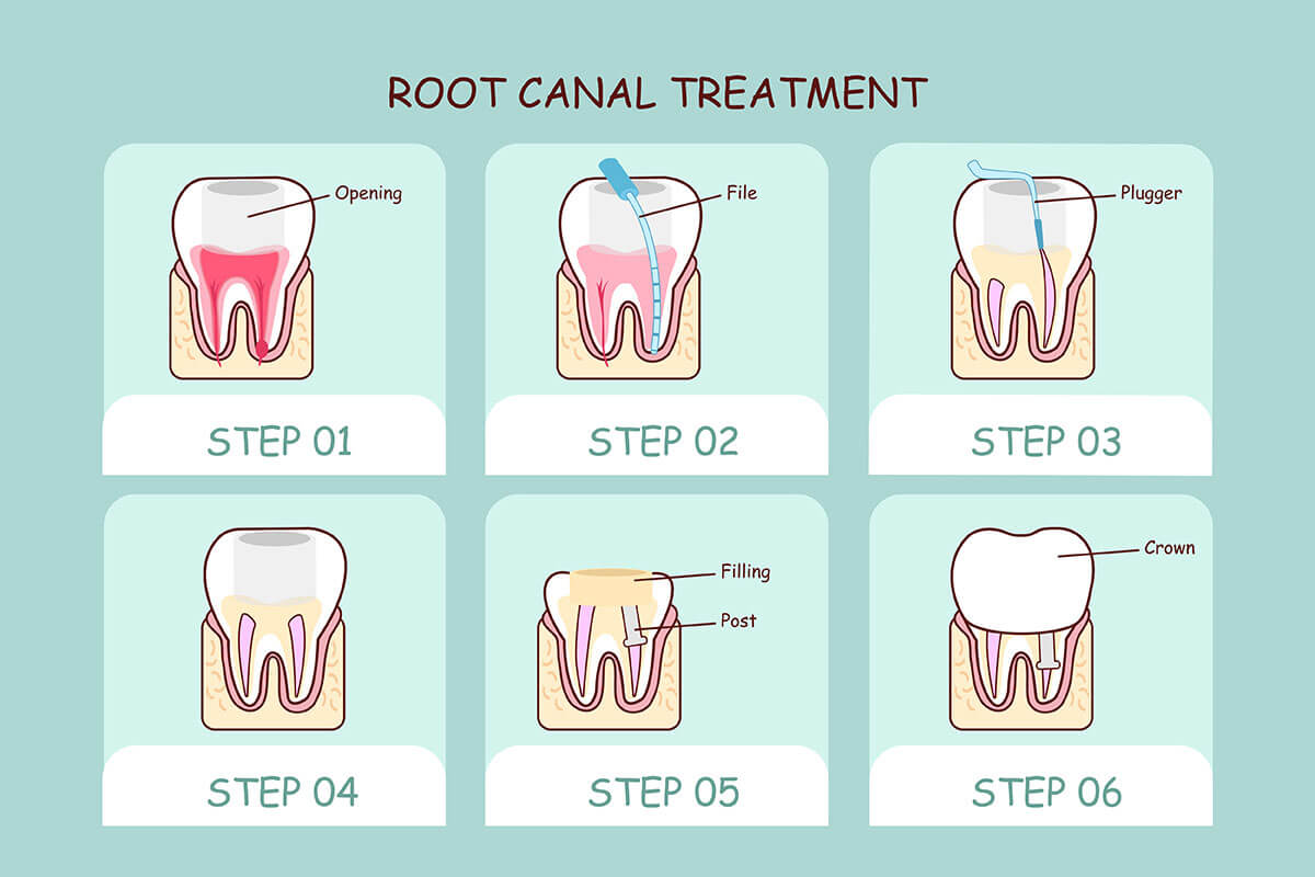 Huffman TX Dental Office