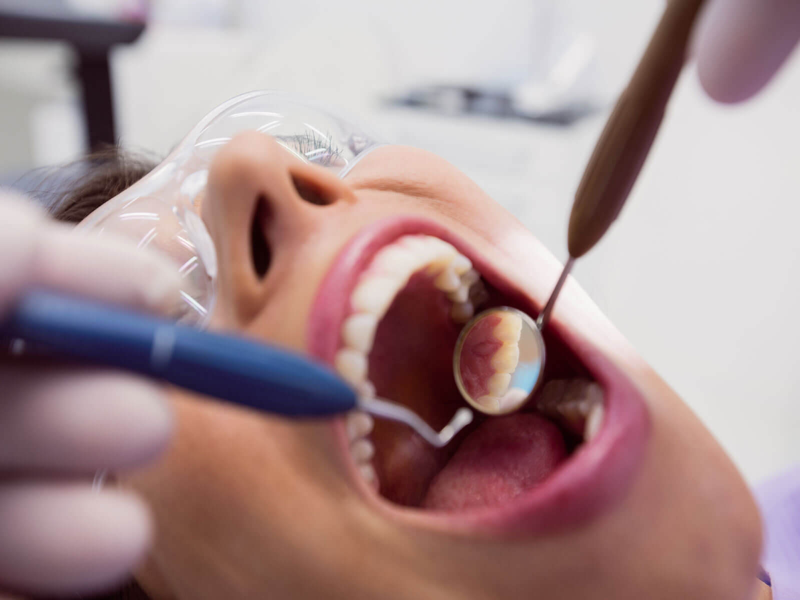 Why Get A Root Canal Instead of Only Taking Antibiotics