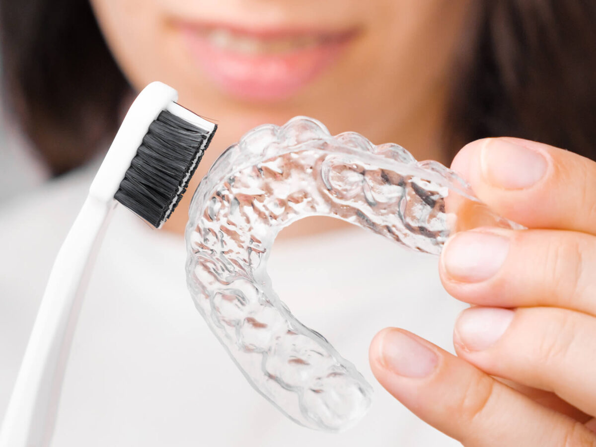 Invisalign Aligners