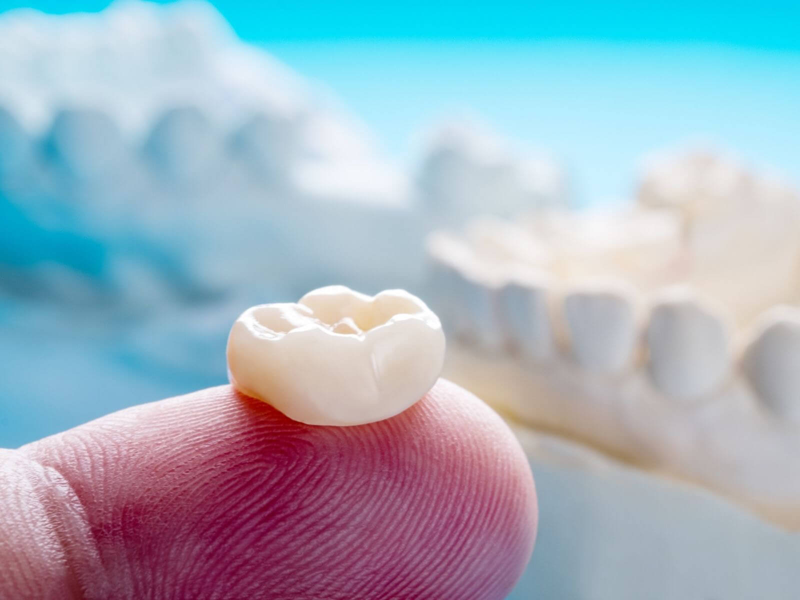 What’s The Difference Between A Crown And A Filling?