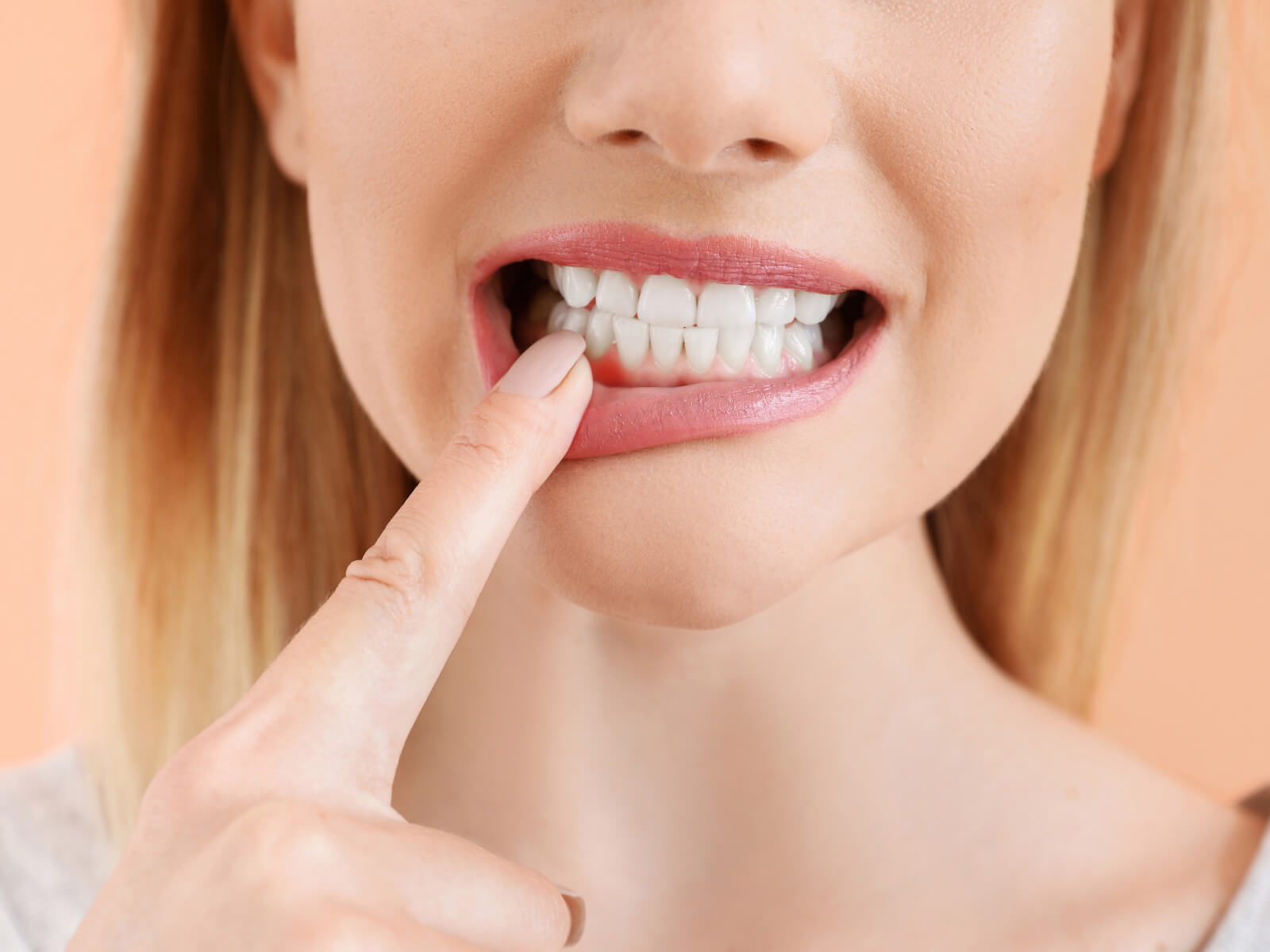 6 Signs of Acid Erosion on Teeth You Shouldn’t Ignore