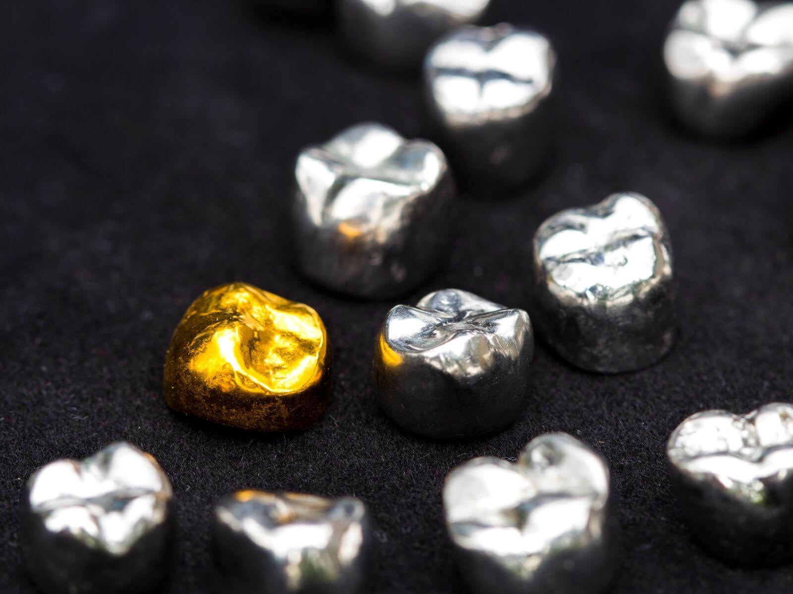 5 Signs Your Dental Crown Needs To Be Replaced