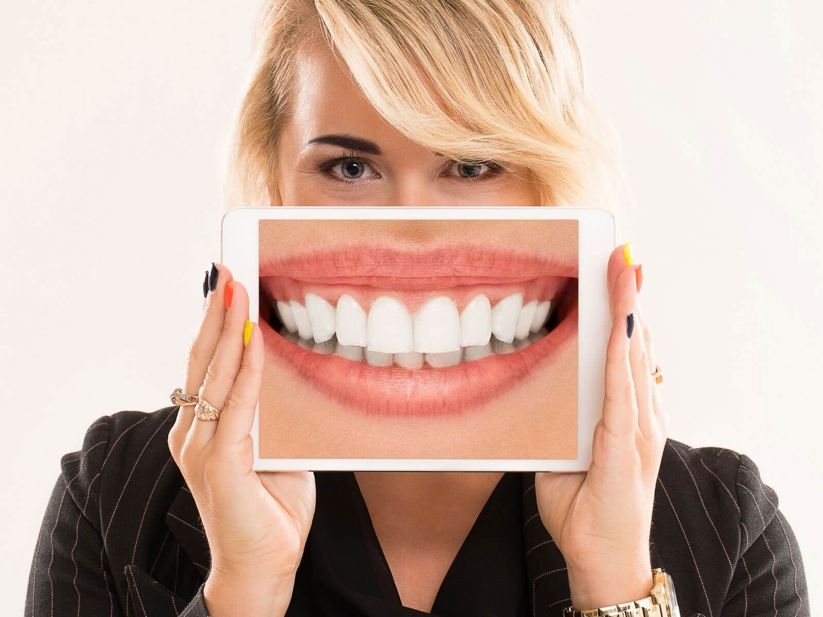 How Professional Teeth Whitening Can Transform Your Smile
