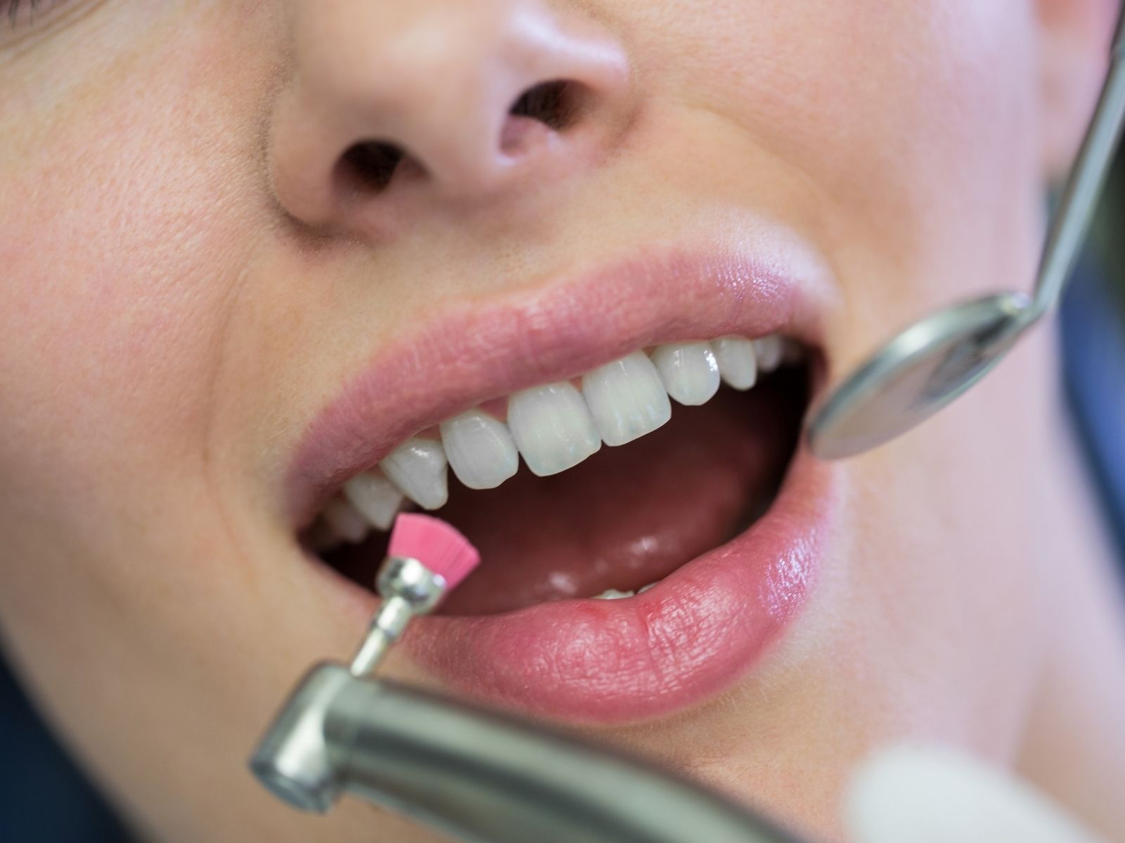 How Long Does a Routine Teeth Cleaning Actually Take?