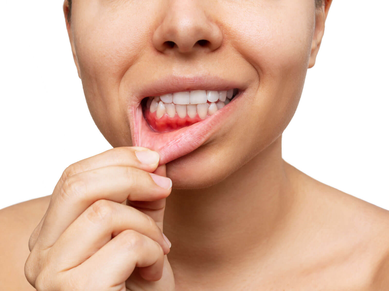How to Stop Bleeding Gums: 10 Home Remedies & When to See a Dentist